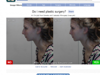 Plastic Surgery Facebook App