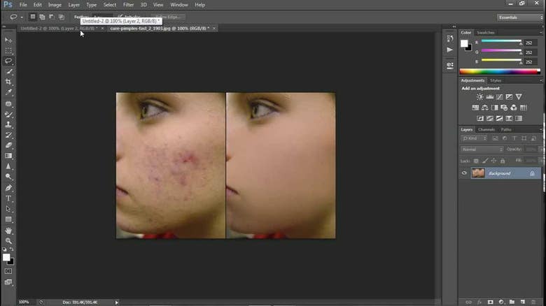 Image editing, acne removal, color correction