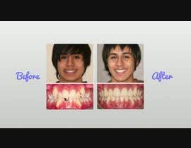 #23 для create a video movie for before and after dental cases for Mall advertising від Pelirock