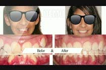 #13 cho create a video movie for before and after dental cases for Mall advertising bởi rizwansarwarcg