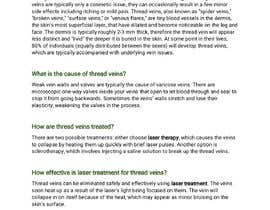 #12 para Write an 800-word blog post titled &quot;Laser Thread Vein Removal&quot; por ZahidulAlam08
