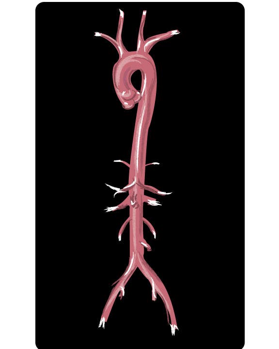 Inscrição nº 3 do Concurso para                                                 I need some Graphic Design for the anatomy of the abdominal/thoracic aorta
                                            